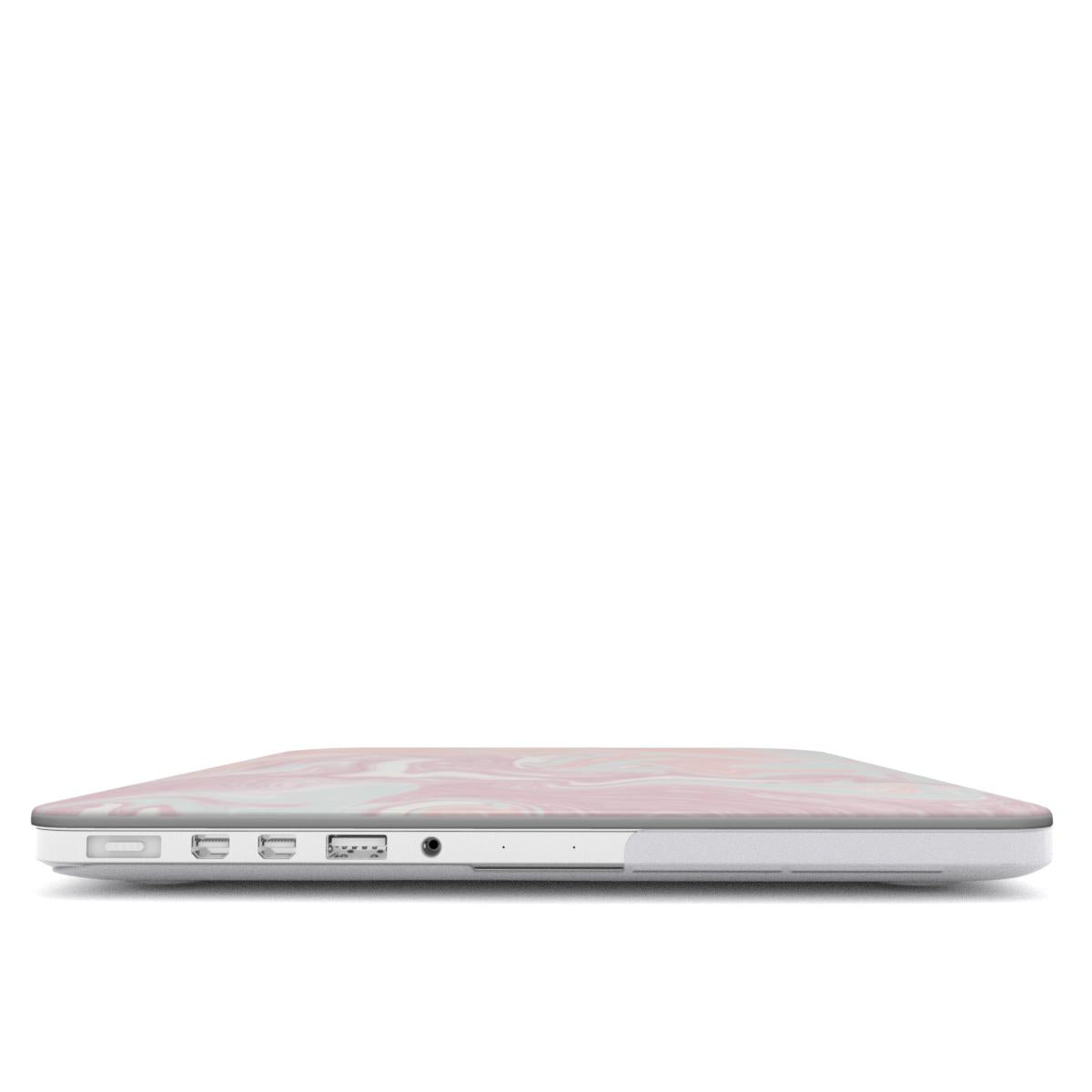 PINK MIX MacBook Case