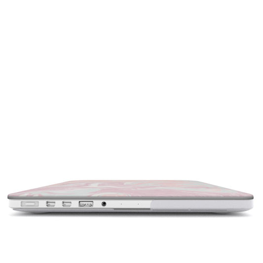 PINK MIX MacBook Case