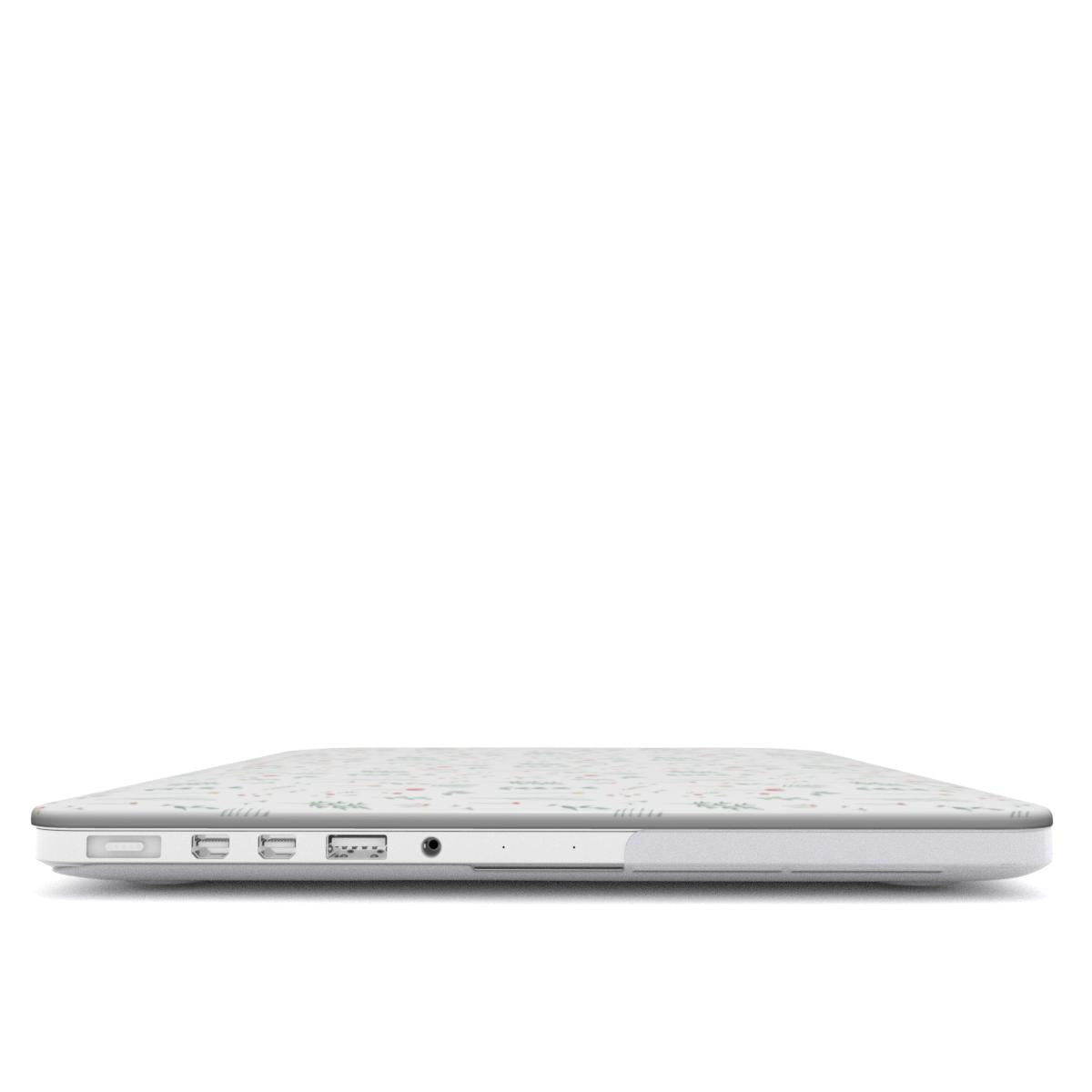 SUBLIME GARDEN - LIGHT MacBook Case