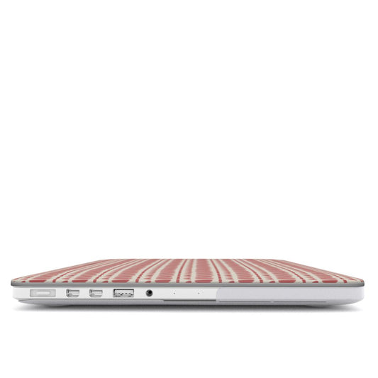 RED LOVE MacBook Case