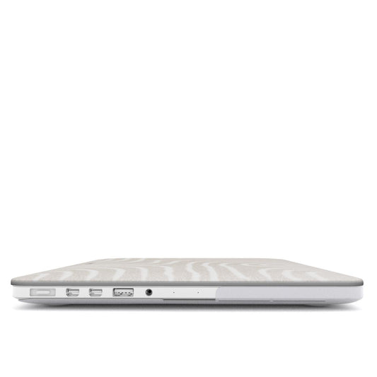 TUNING MacBook Case