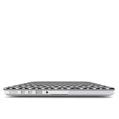 DIAMOND MacBook Case
