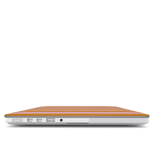 ICE CREAM MacBook Case