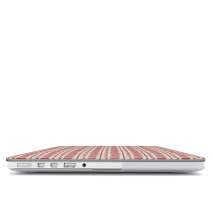 RED LOVE MacBook Case
