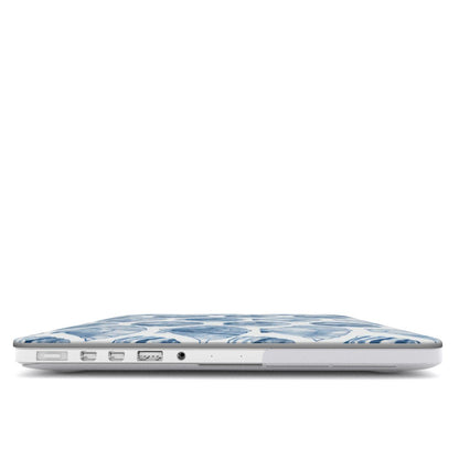 BLUE SHELL MacBook Case