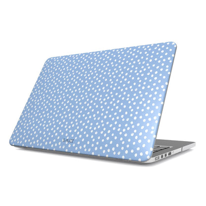 BLUE CONFETTI MacBook Case