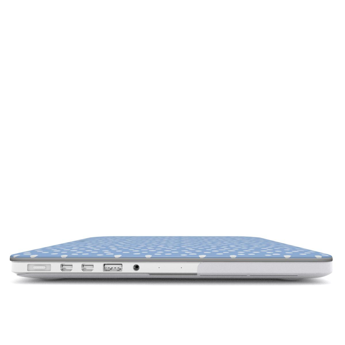 BLUE CONFETTI MacBook Case