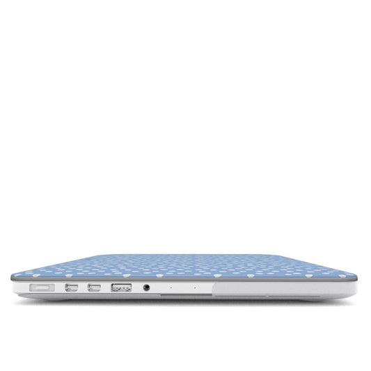 BLUE CONFETTI MacBook Case