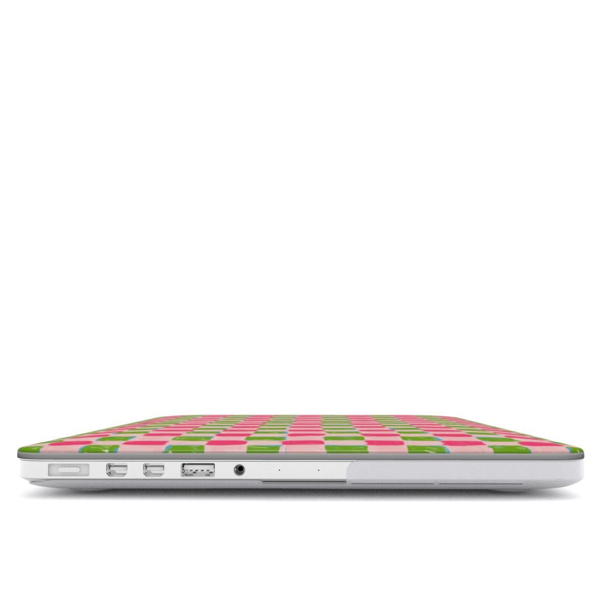 CANDY CHECK MacBook Case